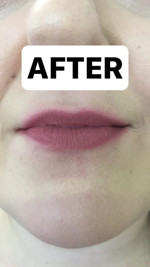 juva lips review after 