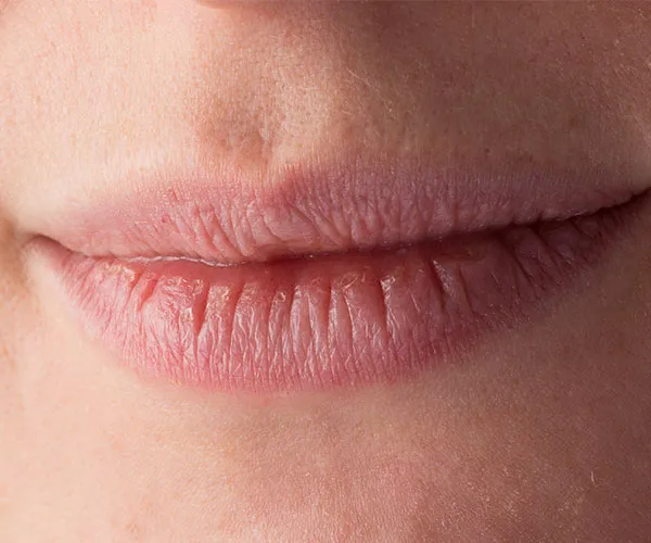 winter lip mistakes 3
